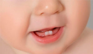 El primer diente de tu bebé: 5 cosas que los padres deben saber