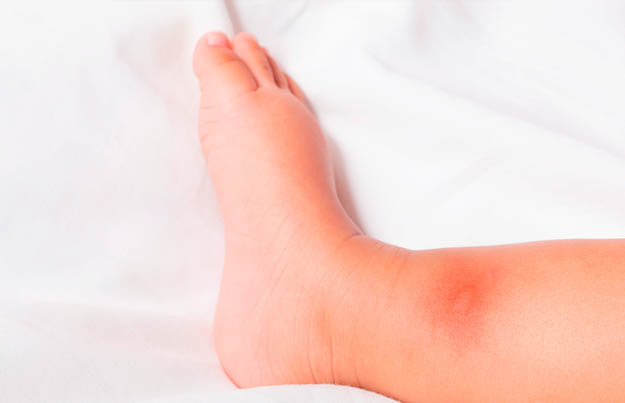 cuidados de bebe