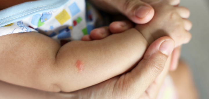 Síntomas de la varicela en niños: Cómo identificarlos y cuándo acudir al médico