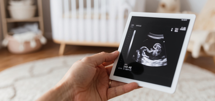 Movimiento fetal: Qué esperar y cuándo Movimiento fetal: Qué esperar y cuándo